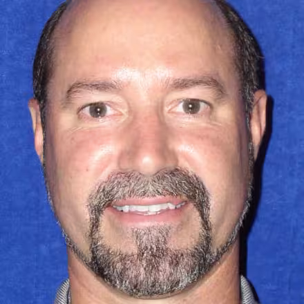 David Denolf