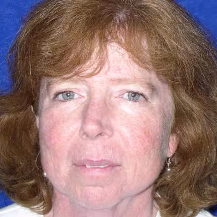 Susan Vanderveen
